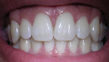 0500063q-219e-220x126.jpg