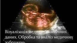 Візуалізація медико-біологічних даних. Обробка та аналіз медичних зображень