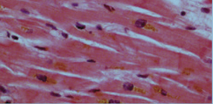 050098ua-fe3a-421x206.png