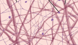 0500db20-cbeb-260x151.png