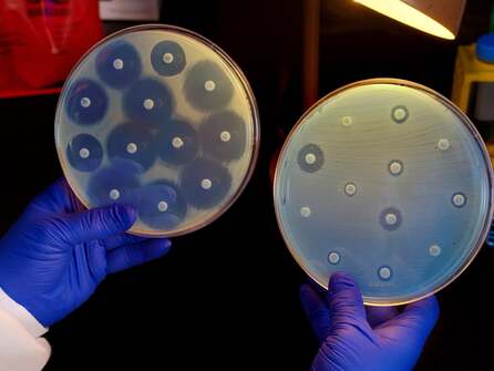 Bacteria developing new ways to resist antibiotics, doctors warn | Drug resistance | The Guardian