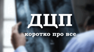 Презентація на тему "Церебральний параліч і особливості фізіології".
