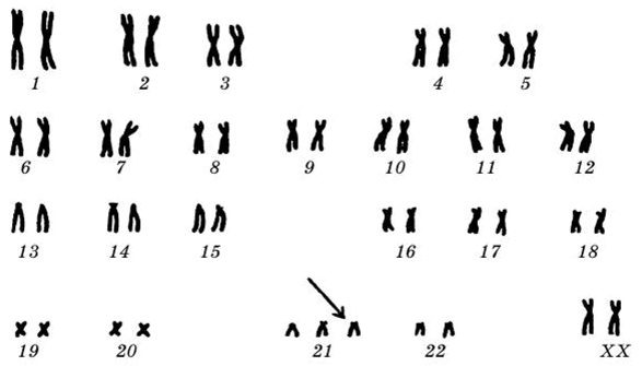 0500m5w2-3152-587x335.png