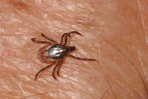 Ixodes ricinus повний вигляд