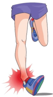 0500s7fp-1d2d-183x331.png