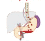 050141ya-ffc6-171x154.png