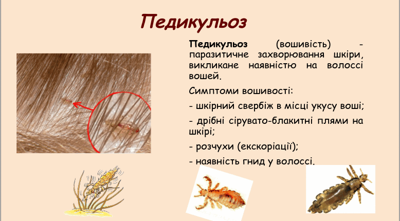 05015xq6-55e0-778x430.png