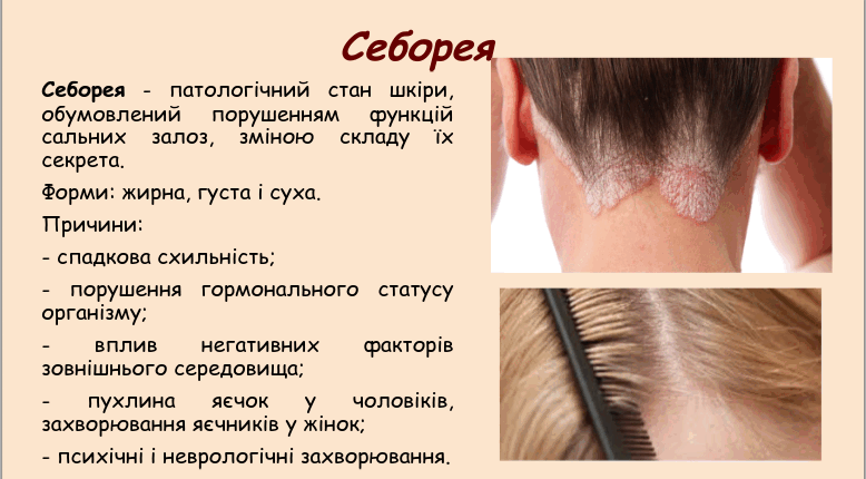 05015xqk-ecf1-778x430.png