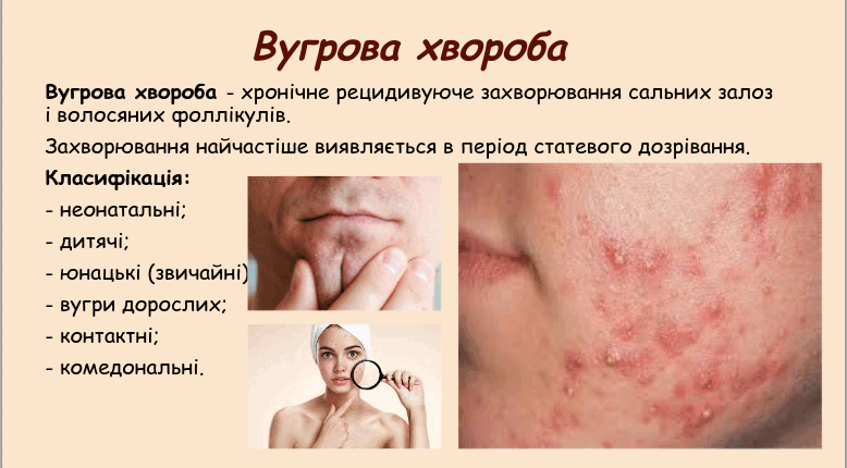05015xr0-fb76-778x430.png