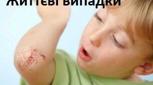 Поговоримо про життєві випадки
