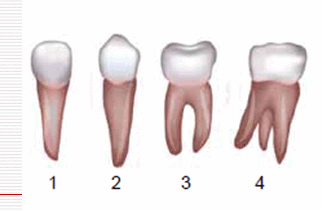 05016hih-9815-321x211.png