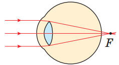 0501b7nr-b047-237x129.jpg