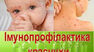Презентація на тему "Імунопрофілактика  краснухи"