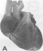0501hvlr-f6a1-141x170.png