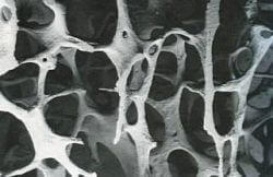 0501rp5v-9fe4-250x162.jpg