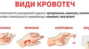 10_клас_Види кровотеч. Алгоритм дій при різних видах кровотеч