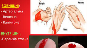 "Перша допомога при кровотечах" урок з природознавства для учнів 9 класу